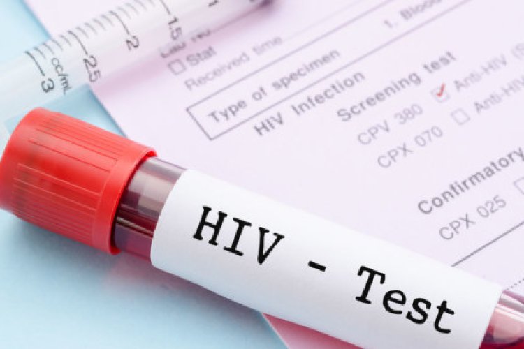 Botswana hits 'historic' UN goal against HIV: report